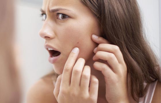 3 نصائح بسيطة وفعالة تبعدك عن كابوس حب الشباب صورة رقم 2