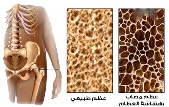 هل فعلا يمكن ان تكشف اصابع اليدين سر شخصيتك؟ صورة رقم 6