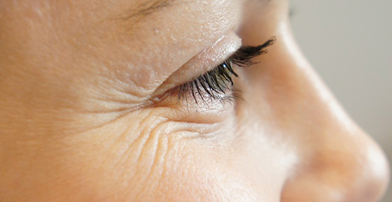 اليك أفضل 5 وصفات طبيعية للتخلص من التجاعيد صورة رقم 4