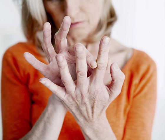 اليكم قائمة بأغرب الأمراض التي تصيب البشر صورة رقم 4