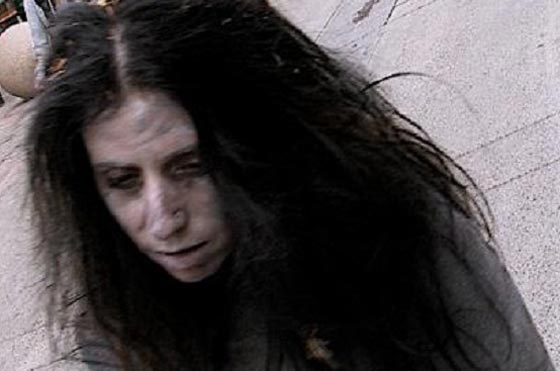 اليكم قائمة بأغرب الأمراض التي تصيب البشر صورة رقم 3