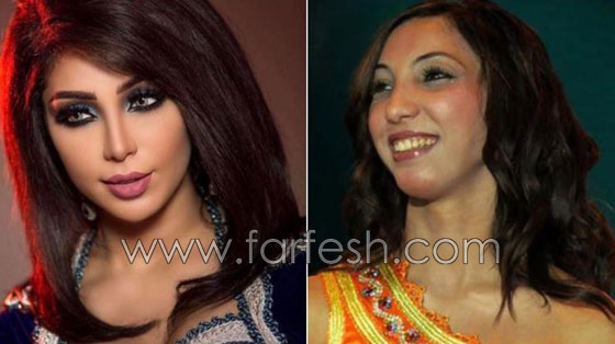 بالصور.. هؤلاء النجمات العرب قبل وبعد عمليات التجميل  Njmat_04