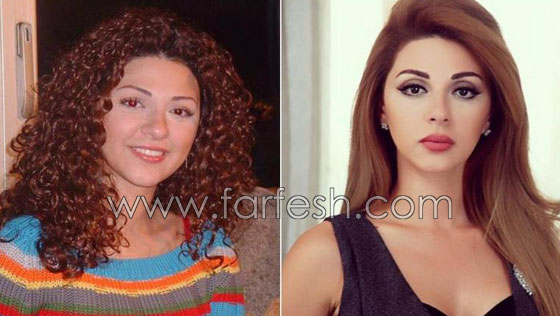بالصور.. هؤلاء النجمات العرب قبل وبعد عمليات التجميل  Njmat_10