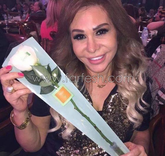 صورة رقم 9 - عمليات تجميل فاشلة شوهت الفنانات العربيات بينهن يسرا، غادة وكارمن صورة رقم 9 - عمليات تجميل فاشلة شوهت الفنانات العربيات بينهن يسرا، غادة وكارمن