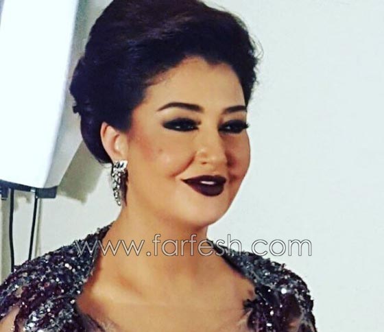 صورة رقم 1 - عمليات تجميل فاشلة شوهت الفنانات العربيات بينهن يسرا، غادة وكارمن صورة رقم 1 - عمليات تجميل فاشلة شوهت الفنانات العربيات بينهن يسرا، غادة وكارمن