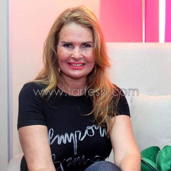 صورة رقم 3 - عمليات تجميل فاشلة شوهت الفنانات العربيات بينهن يسرا، غادة وكارمن صورة رقم 3 - عمليات تجميل فاشلة شوهت الفنانات العربيات بينهن يسرا، غادة وكارمن