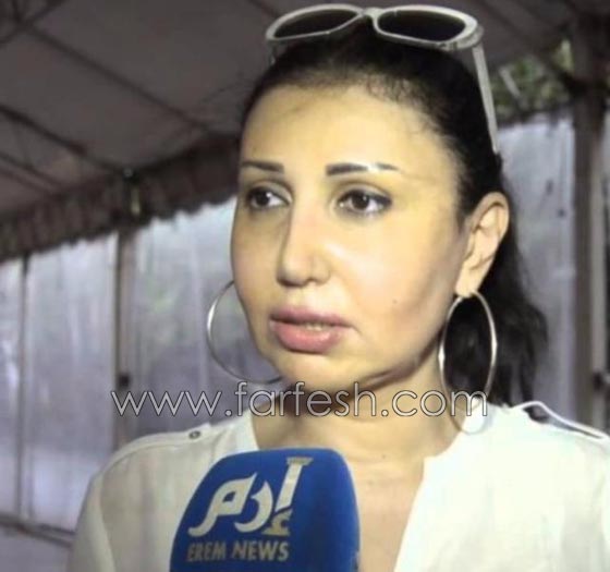 صورة رقم 5 - عمليات تجميل فاشلة شوهت الفنانات العربيات بينهن يسرا، غادة وكارمن صورة رقم 5 - عمليات تجميل فاشلة شوهت الفنانات العربيات بينهن يسرا، غادة وكارمن