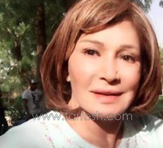 صورة رقم 6 - عمليات تجميل فاشلة شوهت الفنانات العربيات بينهن يسرا، غادة وكارمن صورة رقم 6 - عمليات تجميل فاشلة شوهت الفنانات العربيات بينهن يسرا، غادة وكارمن