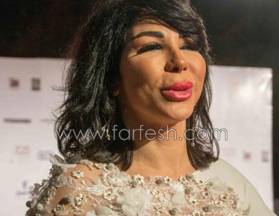 صورة رقم 8 - عمليات تجميل فاشلة شوهت الفنانات العربيات بينهن يسرا، غادة وكارمن صورة رقم 8 - عمليات تجميل فاشلة شوهت الفنانات العربيات بينهن يسرا، غادة وكارمن