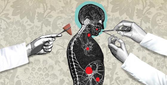 9 امراض نفسية تمنح المصابين بها ذكاء وقدرات خارقة  صورة رقم 3