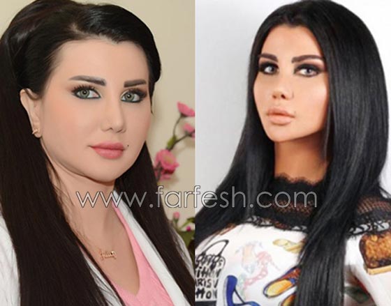 صور فنانات قمن بتكبير الشفاه بينهن هيفاء واحلام وغادة الفرق كبير قبل وبعد منتديات درر العراق