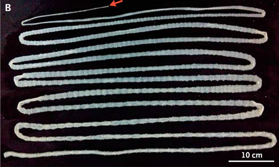 انتبهوا... اليكم أخطر وأغرب حميات غذائية في العالم صورة رقم 3 انتبهوا... اليكم أخطر وأغرب حميات غذائية في العالم صورة رقم 3