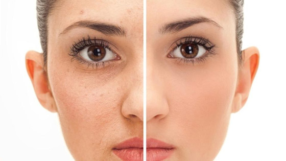  4 طرق جديدة وفعّالة لتنظيف البشرة من الشوائب المتراكمة صورة رقم 5