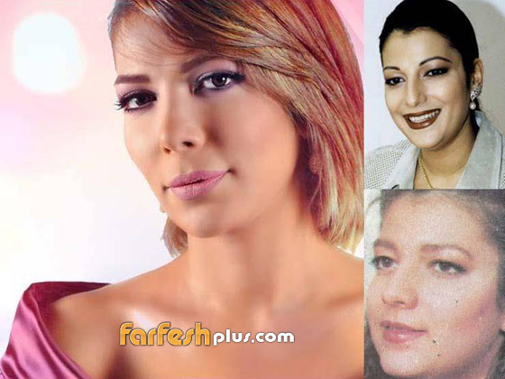 صورة رقم 6 - بالصور: نجمات عربيات اعترفن باجراء عمليات تجميل، وبعضهن ندمن! صورة رقم 6 - بالصور: نجمات عربيات اعترفن باجراء عمليات تجميل، وبعضهن ندمن!
