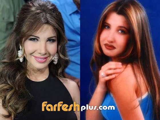 صورة رقم 7 - بالصور: نجمات عربيات اعترفن باجراء عمليات تجميل، وبعضهن ندمن! صورة رقم 7 - بالصور: نجمات عربيات اعترفن باجراء عمليات تجميل، وبعضهن ندمن!