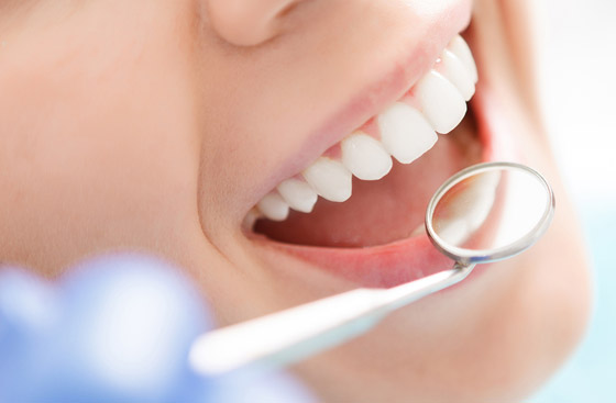 كل ما تريد معرفته عن تنظيف الأسنان وتبييضها وحمايتها من التصبغات صورة رقم 20