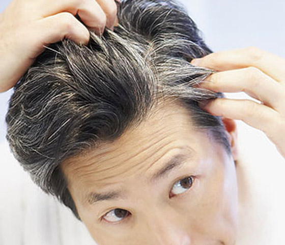 عادات يومية خاطئة تسرع ظهور الشيب صورة رقم 4