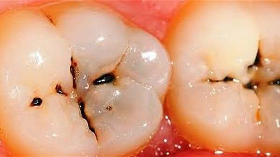 قائمة بأكثر الأمراض انتشاراً في الوطن العربي صورة رقم 1 قائمة بأكثر الأمراض انتشاراً في الوطن العربي صورة رقم 1