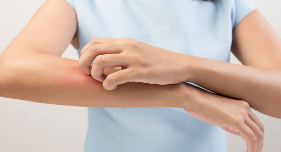 مواد موجودة في الأزياء تؤذي البشرة وتكون مهيجة لها! تعرفوا إليها.. صورة رقم 4