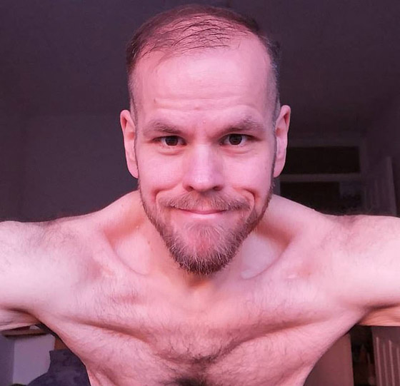 رجل يخسر 215 كيلوغراما ويصبح أكبر خاسر وزن.. إليكم ما تغير! صورة رقم 8