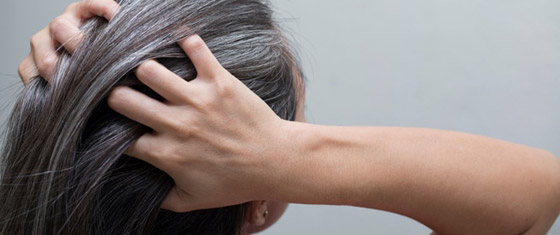 هذه أسباب للشيب المبكر... صورة رقم 2