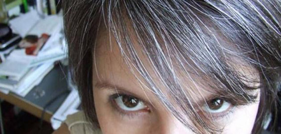 هذه أسباب للشيب المبكر... صورة رقم 4