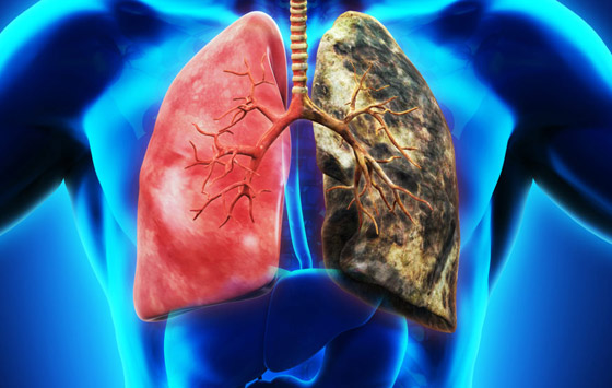 احذروا.. 6 أمراض تتطور من دون ظهور أعراض لها! صورة رقم 4