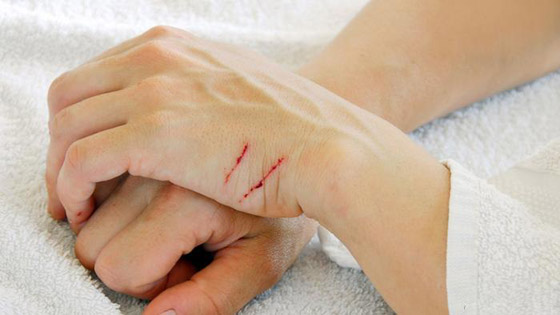 فوائد العسل فوق المتوقع: غذاء ودواء وصحة عالية وجمال البشرة صورة رقم 3 فوائد العسل فوق المتوقع: غذاء ودواء وصحة عالية وجمال البشرة صورة رقم 3