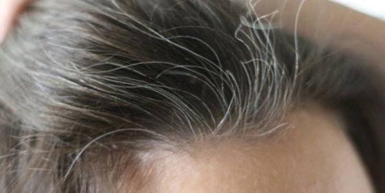 عادات يومية خاطئة تسرع ظهور الشيب صورة رقم 1