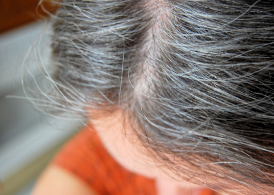 عادات يومية خاطئة تسرع ظهور الشيب صورة رقم 3