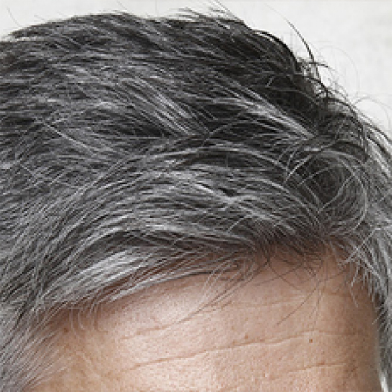 عادات يومية خاطئة تسرع ظهور الشيب صورة رقم 5