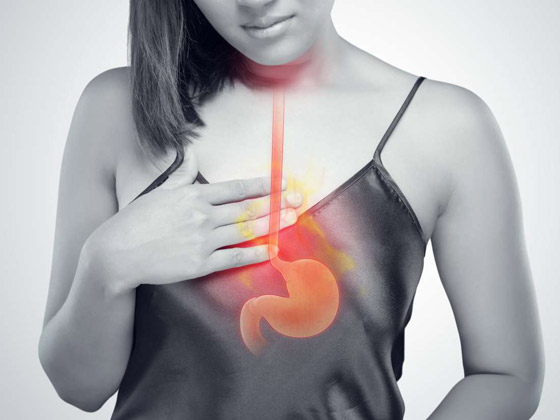 حُرقة المعدة.. أسبابها وكيف يمكن مواجهتها؟  صورة رقم 2