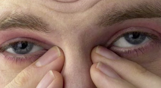 بالفيديو.. عادات يومية سيئة تدمر العين وتهدد صحتها صورة رقم 1