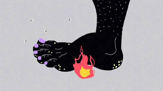 بالفيديو: أبرز أسباب تعرّق الأقدام وطرق علاجها صورة رقم 4