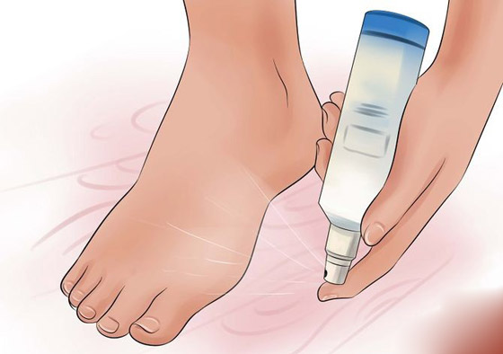 بالفيديو: أبرز أسباب تعرّق الأقدام وطرق علاجها صورة رقم 1