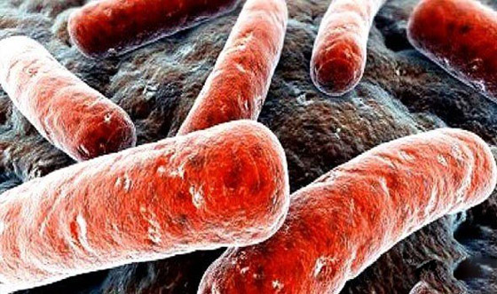 إليكم 10 أمراض معدية التي تنتقل من الحيوانات إلى البشر صورة رقم 3 إليكم 10 أمراض معدية التي تنتقل من الحيوانات إلى البشر صورة رقم 3