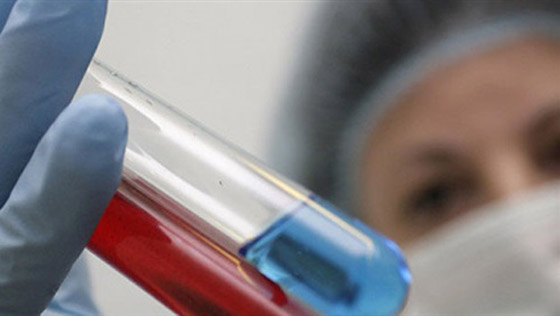 إليكم 10 أمراض معدية التي تنتقل من الحيوانات إلى البشر صورة رقم 6 إليكم 10 أمراض معدية التي تنتقل من الحيوانات إلى البشر صورة رقم 6