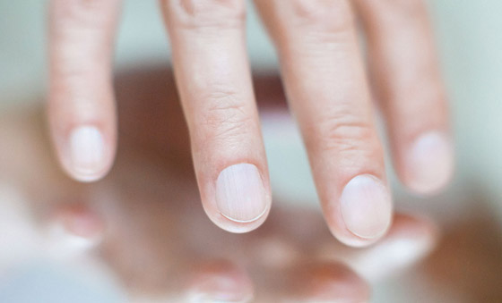 الأظافر نافذة لصحة الجسم.. ماذا يقول تحول لون أظافرك عن صحتك؟ صورة رقم 1