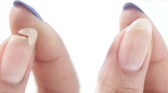 ما هو  السبب الحقيقي وراء تقصف الأظافر؟! صورة رقم 1