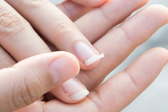 ما هو  السبب الحقيقي وراء تقصف الأظافر؟! صورة رقم 2