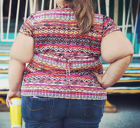 سبب إضافي لتنزيل الوزن: السمنة تسبب مرض السرطان أكثر من السجائر! صورة رقم 2 سبب إضافي لتنزيل الوزن: السمنة تسبب مرض السرطان أكثر من السجائر! صورة رقم 2