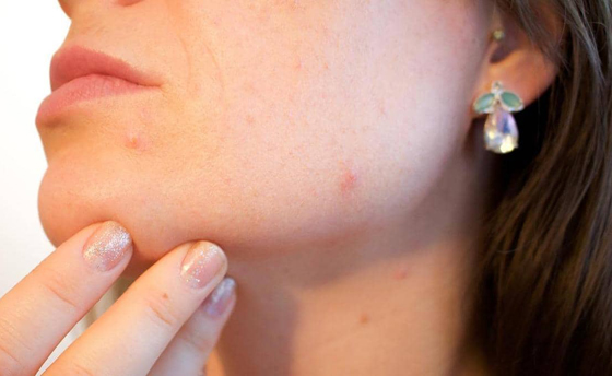 6 أطعمة تسرع ظهور 