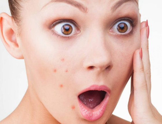 6 أطعمة تسرع ظهور 