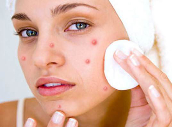 6 أطعمة تسرع ظهور 