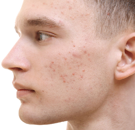 6 أطعمة تسرع ظهور 