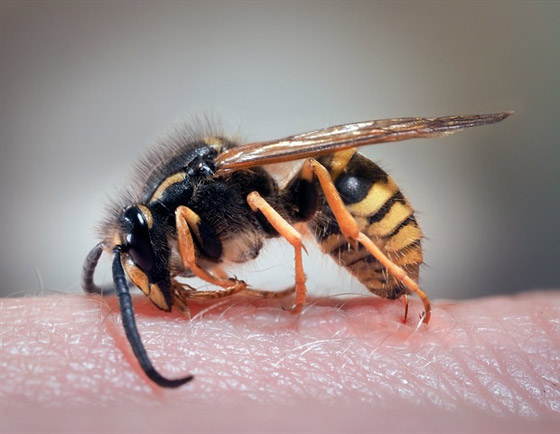 طرق سهلة لمعالجة لدغات الحشرات صورة رقم 5