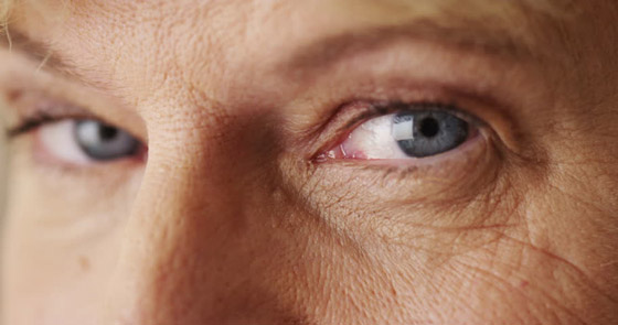 للحفاظ على نظرات شابة ومشرقة .. لكل عمر عناية خاصة لمحيط العينين صورة رقم 4