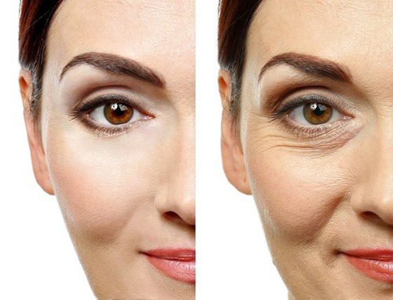 للحفاظ على نظرات شابة ومشرقة .. لكل عمر عناية خاصة لمحيط العينين صورة رقم 2