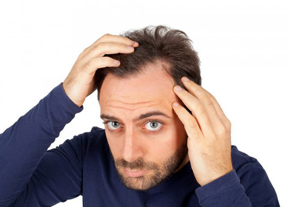 هذه الأطعمة ستوصلكم إلى الصلع.. إحذروها صورة رقم 5