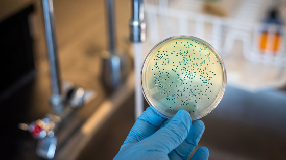  بكتيريا مقاومة للعقاقير تنتشر في مستشفيات أوروبا وإسرائيل صورة رقم 1